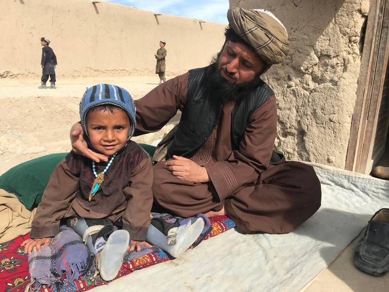 Medical workers were unable to reach Hazrat Ali's home in Kandahar during recent vaccination drives and he has since lost the use of his legs after contracting polio. Qudratullah Razwan for The National