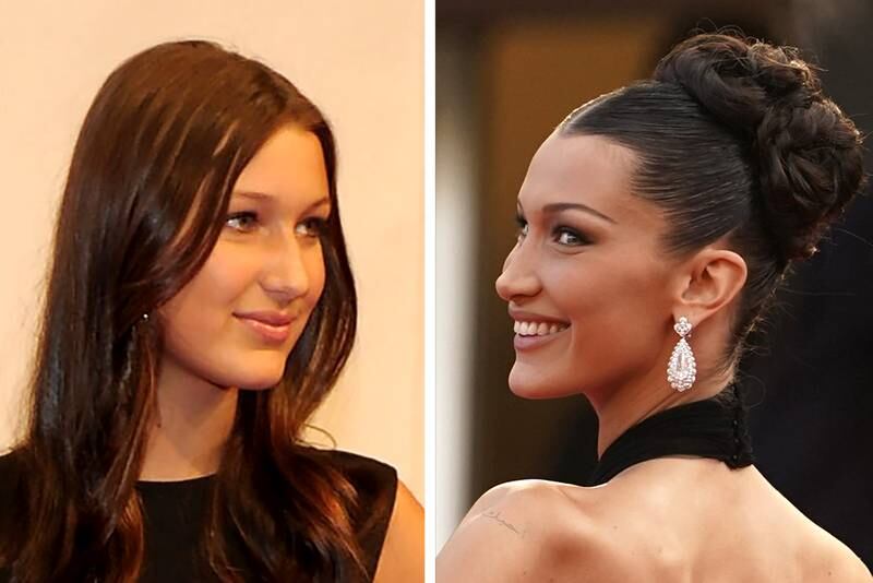 Bella Hadid in 2010, left, and in 2021. The model has revealed she underwent a rhinoplasty procedure at the age of 14, after saying she was upset at being Gigi's 'uglier sister'. Getty Images, AP