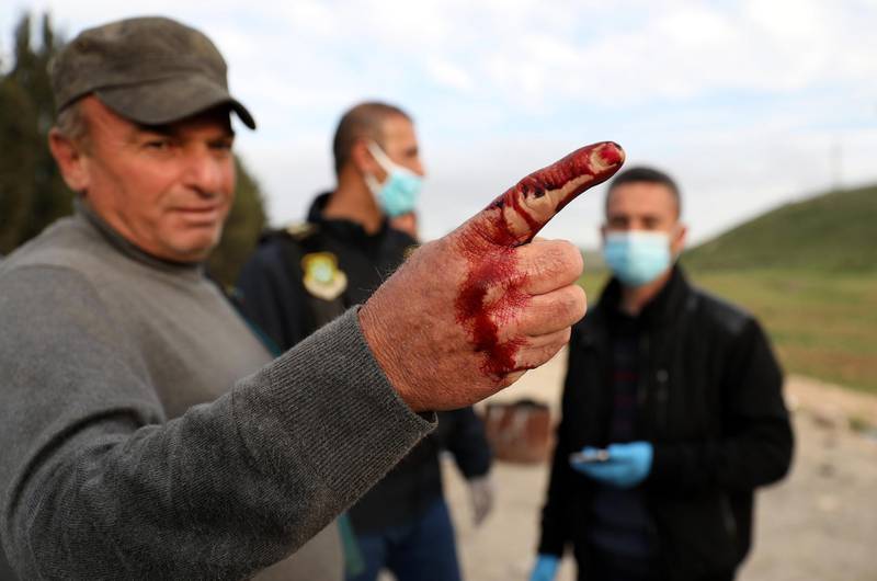 Palestinian medics use a special ink to mark the fingers of Palestinian workers who cross back from Israel, at Tarqumiya crossing, near the West Bank town of Hebron.  EPA