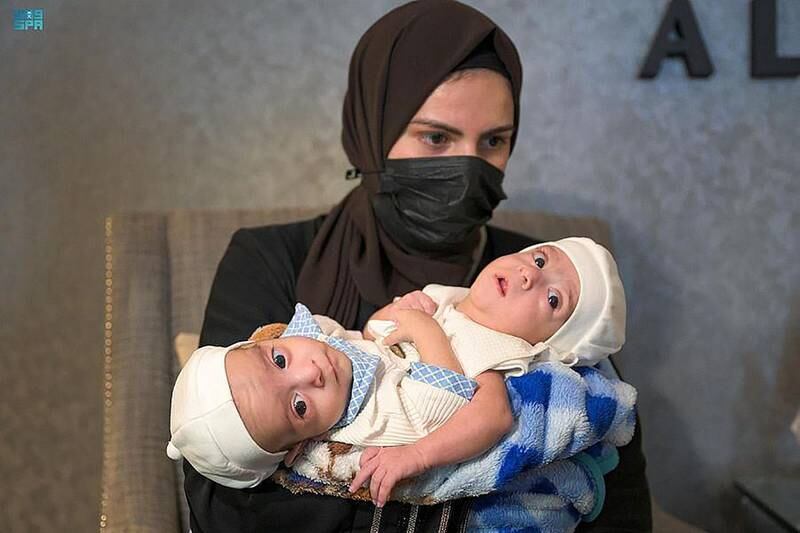 Iraqi Siamese twins Omar and Ali arrive in Riyadh to ascertain the possibility of separation surgery. SPA