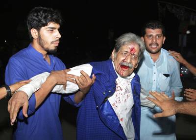 People hold an injured supporter of former Prime Minister Nawaz Sharif after a clash with police in Lahore, Pakistan, on Friday, July 13, 2018. AP Photo