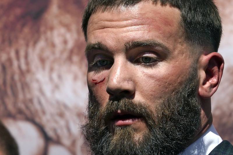 Caleb Plant is seen with a cut under his eye. AP