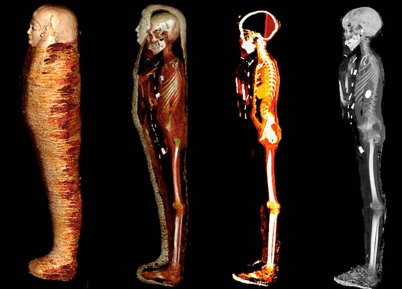 The mummified remains of a teenage boy, nicknamed the "Golden Boy", who has been analysed using CT scanning by researchers in Egypt. The CT scans showed the boy was decorated with 49 amulets, many of them made from gold. Photo: Professor Sahar Saleem