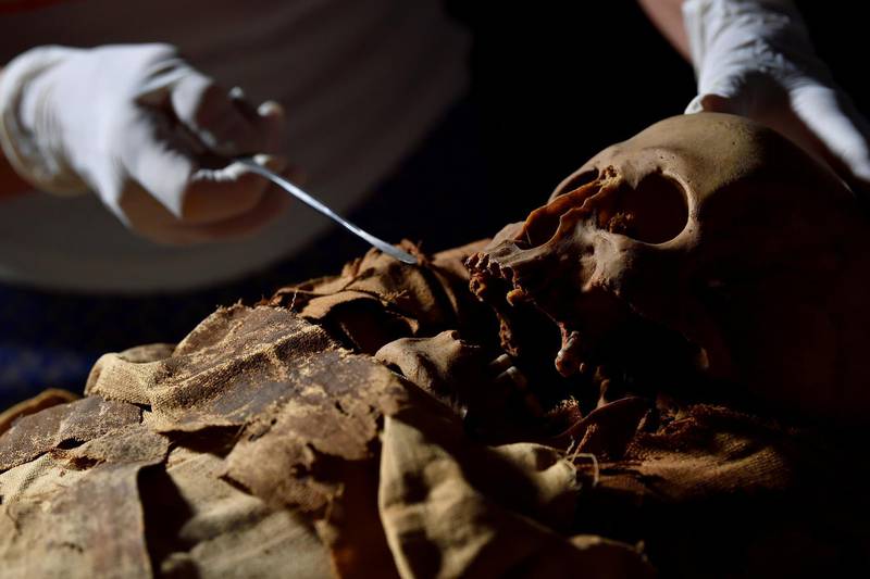 A researcher prepares to move the mummy to the hospital in Milan.