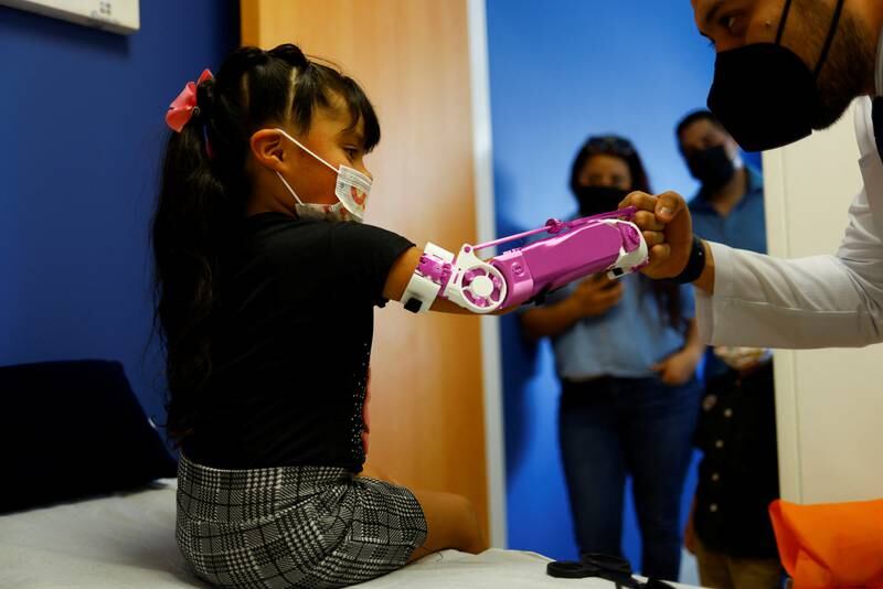 Monserrath Montanez, 4, receives a 3D prosthetic arm with a Spider-Woman design that was donated by orthopedist Oscar Juarez, who gives prosthetics to low-income children without arms, in Ciudad Juarez, Mexico. Reuters 