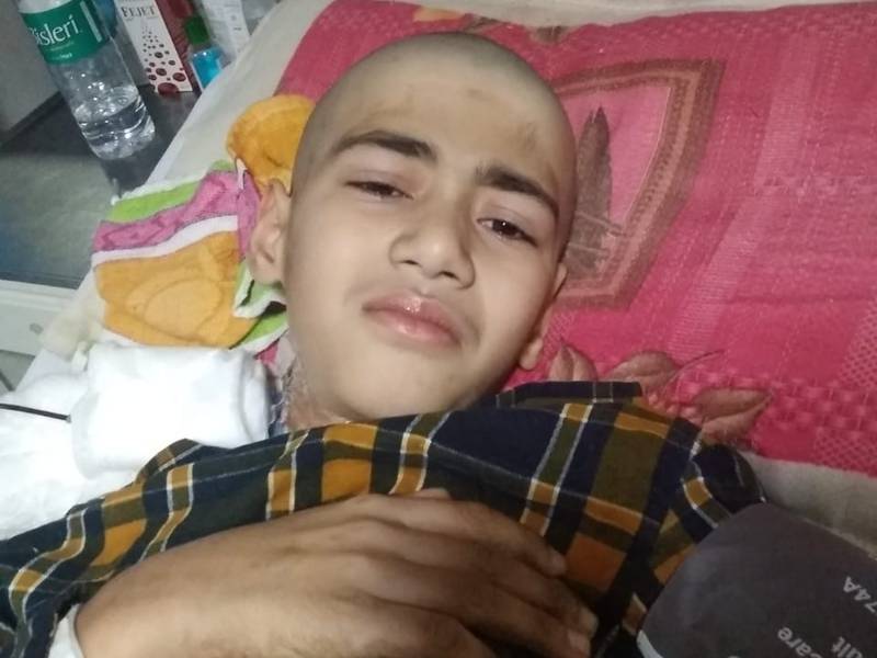 Manjeet Kumar, 11, narrowly survived a road accident but has since then undergone 10 surgeries and is unable to stand on his feet. Picture: Ashok Kumar