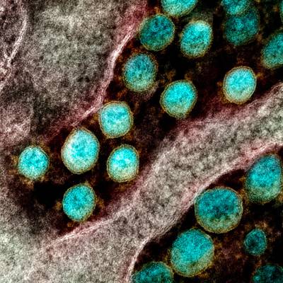 A National Institutes of Health transmission electron micrograph of the coronavirus.