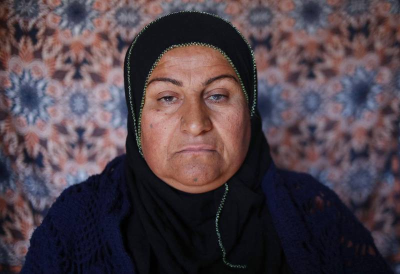 Halala Jalal, 47, one of the victims of the Halabja Chemical attack in 1988, poses for a picture in the Kurdish town, 300 kms (190 miles) northeast of Baghdad. AFP
