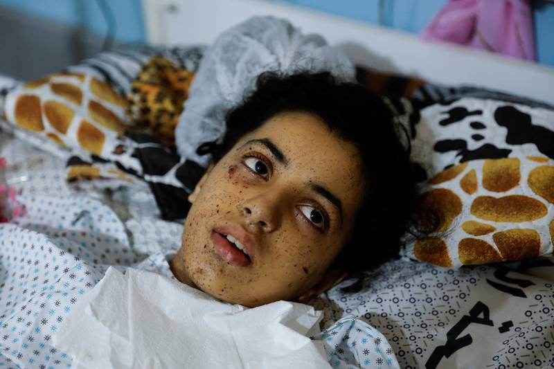 Rahaf Salman, 11, lost her limbs during Israel-Gaza fighting. Reuters