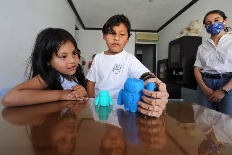 With his sister and two brothers looking on, Juan tried out his new limb for the first time in the family living room, slowly flexing at the elbow to close the hand. Reuters