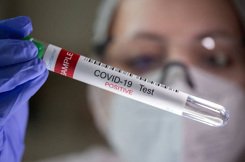 Scientists say the XBB1.5 variant can bind more easily, increasing transmissibility. Reuters