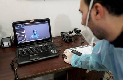 Using a 3D scanner in its clinic and a 3D printer owned by a Gaza business, Medecins Sans Frontieres-France provides compressive masks for Gaza facial burn victims to help them heal and prepare some for reconstructive surgery.