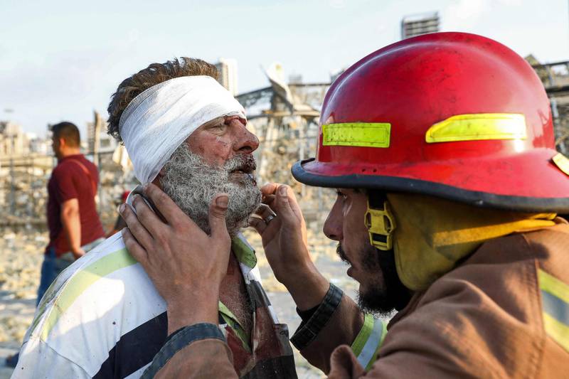 A wounded man is checked by a fireman near the scene of the explosion in Beirut. AFP