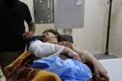 An Iraqi woman receives medical treatment at a local hospital in Hamdaniya, in Iraq's Nineveh province. EPA