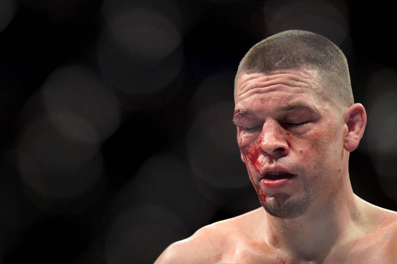 Nate Diaz during his fight with Jorge Masvidal at UFC 244. AFP