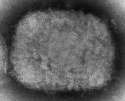 This 2003 electron microscope image made available by the Centres for Disease Control and Prevention shows a monkeypox virion, obtained from a sample associated with the 2003 prairie dog outbreak. AP