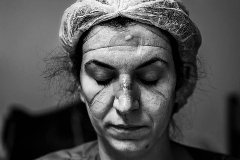 Brazilian photographer Ary Bassous’s photo of Dr Juliana Ribeiro after eight hours of continuous work in the Covid-19 emergency room has won him the grand prize at the 10th season of Hipa