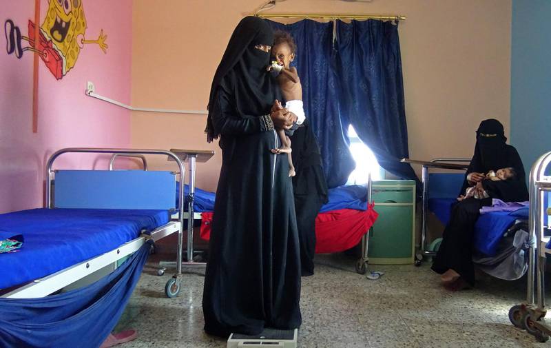 A mother holds her malnourished child as they wait for treatment in Al Mutaynah, Tuhayta, Yemen.