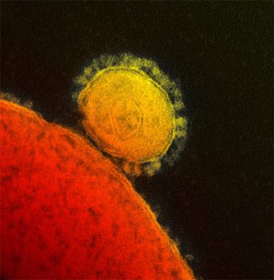 An electron microscope image by the National Institute of Allergy and Infections Diseases – Rocky Mountain Laboratories shows a coronavirus particle, also known as the Mers virus, centre. AP Photo