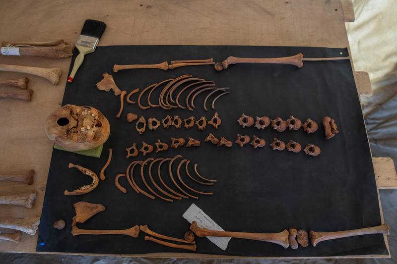 Ancient skull and bones are on display that Egyptian archaeologist Zahi Hawass and his team unearthed in a vast necropolis filled with burial shafts, coffins and mummies dating back to the New Kingdom 3000 BC in Saqqara, south of Cairo, Egypt. AP