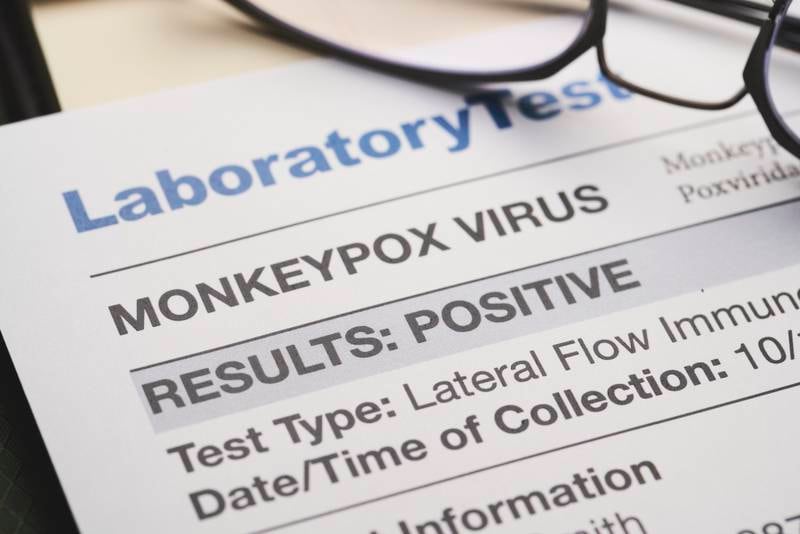 Jordan has ordered monkeypox testing supplies. Getty