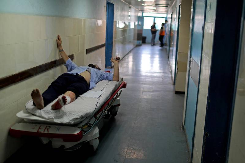 A wounded Palestinian man lies on a bed in Al Shifa hospital in Gaza City. Reuters