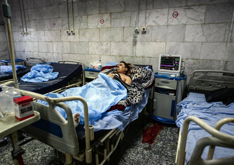 A member of the Hashed Al Shaabi paramilitaries injured in an area targeted by US military air strikes, receives treatment while lying on a bed at Hilla General Teaching Hospital in Iraq's central city of Hilla on March 13, 2020.  AFP