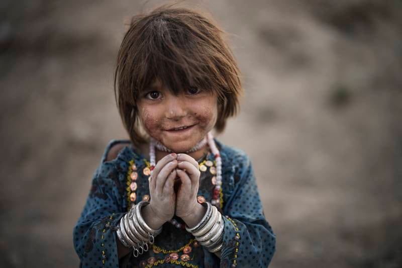 Laila plays in a poor Kabul neighborhood where hundreds of internally displaced people from the eastern part of Afghanistan have been living for years. Photo: AP