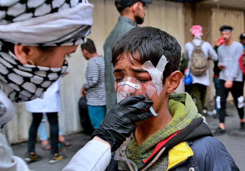 An young injured protester receives first aid during clashes with security forces in Baghdad, Iraq. AP Photo