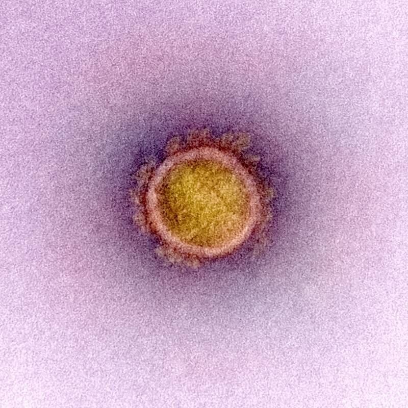A National Institutes of Health transmission electron micrograph of the coronavirus particle.