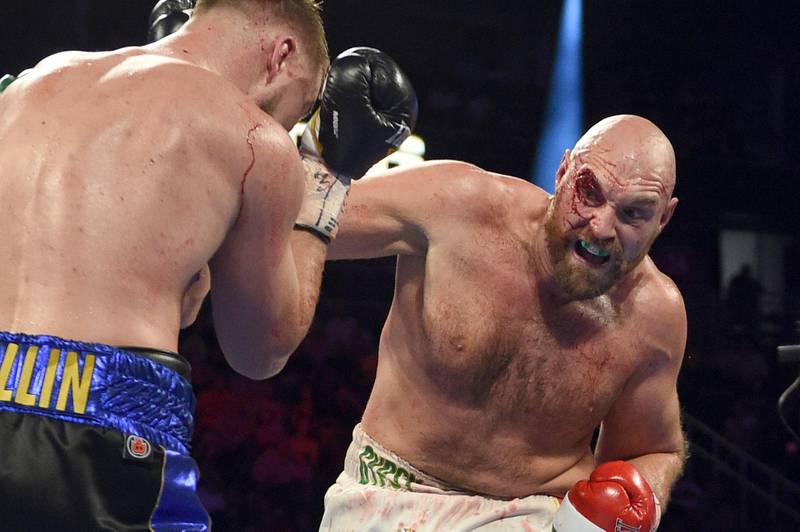 Tyson Fury overcame horrendous cuts to his right eye to take a unanimous decision over Otto Wallin in a bruising heavyweight encounter in Las Vegas. AFP