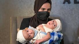 Iraqi conjoined twins arrive in Riyadh for possible surgery