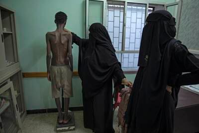 In August 2019, Ras Al Ara Hospital staff assess Ethiopian migrant Mohammed Hussein, 19, who is severely malnourished because of imprisonment and abuse by smugglers