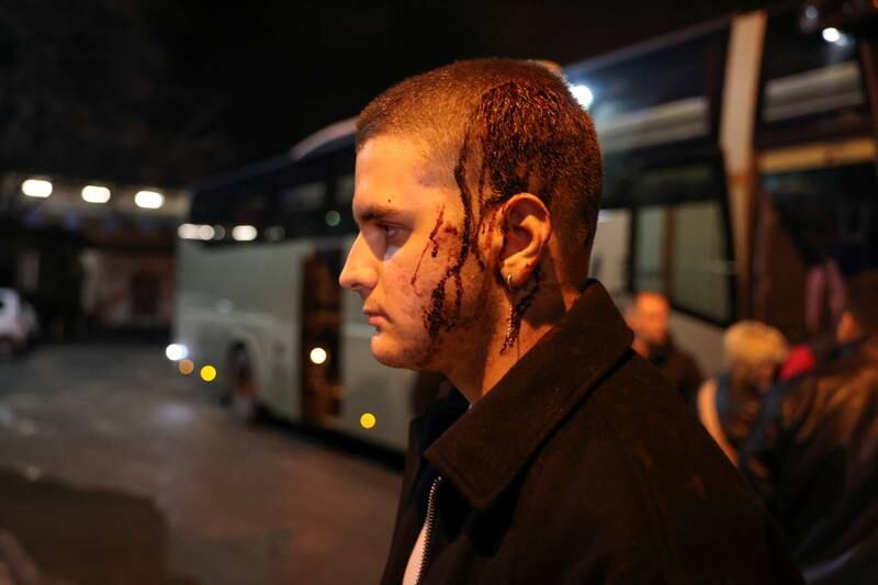 An injured passenger arrives in Thessaloniki, Greece. Reuters