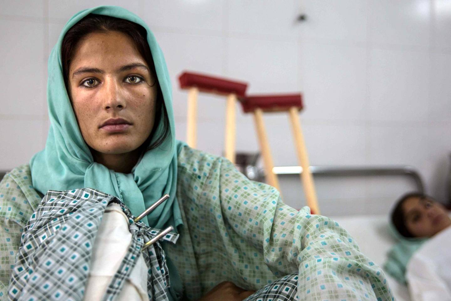 Razia, 16, recovers at the Emergency Hopsital in Helmand's provincial capital Lashkargar after she was injured in a blast. Photo by Stefanie Glinski