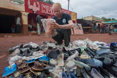 Jammtain Frenando, a person living with albinism, at work in Malawi's capital Lilongwe. AFP