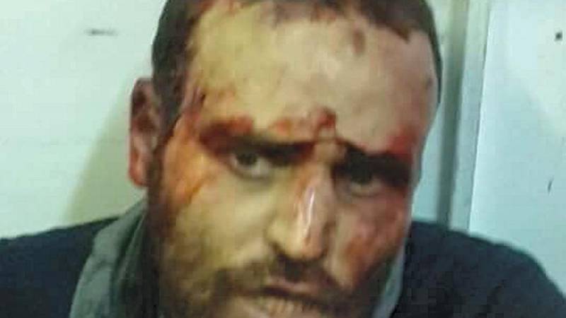 Hisham Ashmawi after his capture in the former ISIS stronghold of Derna, Libya  LNA