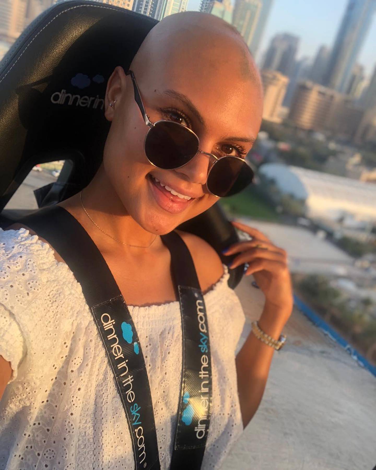 Taylor has suffered with alopecia since she was 15. Yasmin Taylor / Instagram 