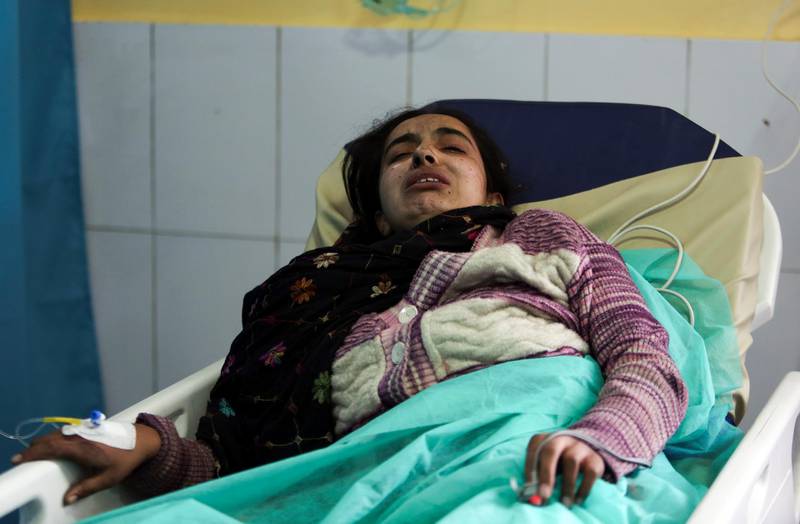 An Afghan Sikh woman wounded in a gunmen attack lies in a hospital in Kabul, Afghanistan. AP Photo
