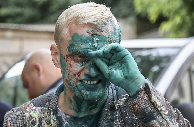 Vitaliy Shabunin, head of the non-governmental Anti-Corruption Action Centre, reacts after he was splashed with brilliant green substance during a rally in front of the Specialized Anti-Corruption Prosecutor's Office in Kiev, Ukraine July 17, 2018. REUTERS/Viacheslav Ratynskyi     TPX IMAGES OF THE DAY