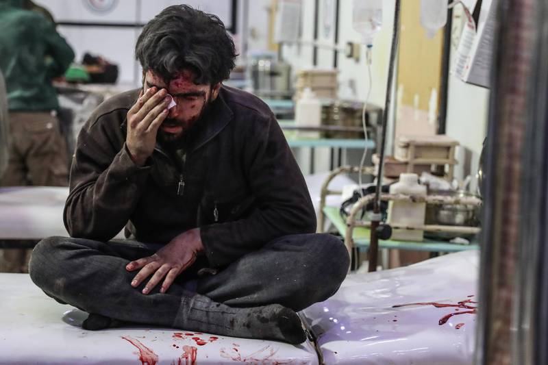An injured man gets treatment at a hospital in rebel-held Douma, Eastern Ghouta. Mohammed Badra / EPA
