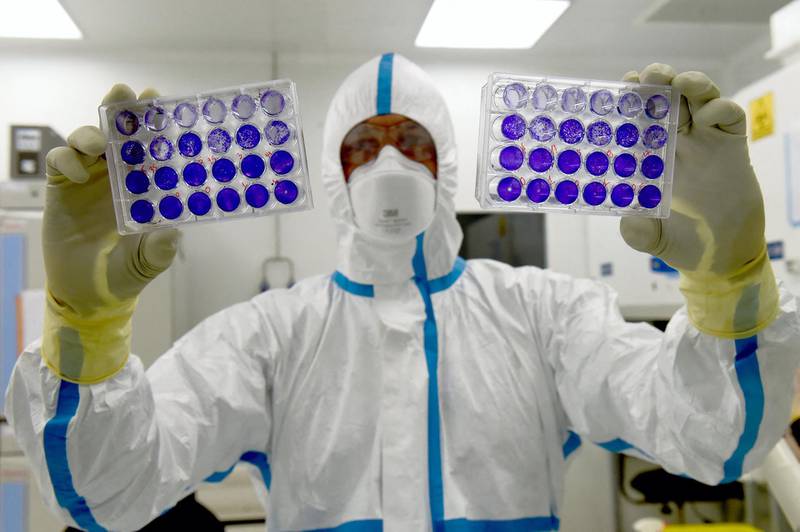French engineer-virologist Thomas Mollet looks at 24 well plates adherent cells monolayer infected with a Sars-CoV-2 virus at the Biosafety level 3 laboratory (BSL3) of the Valneva SE Group headquarters in Saint-Herblain, near Nantes, western France, on July 30, 2020. - Could the Covid-19 vaccine be found by a biotechnology company in western France, far from major global research centers. The hypothesis is more than plausible for the British government, which has just signed an important agreement with it. (Photo by JEAN-FRANCOIS MONIER / AFP)