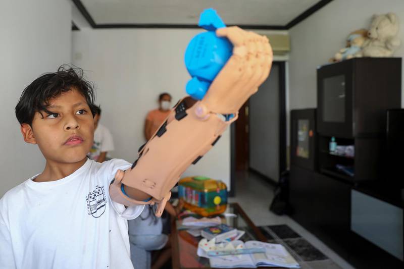 Juan Moyolema, an 8-year-old boy who was born missing the lower part of his left arm, raises a toy with a 3D printed tailor-made prosthetic given to him by Ayudame3D at his home in Parla, near Madrid, Spain. Reuters