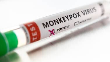 An image that illustrates this article UK government issues new monkeypox advice