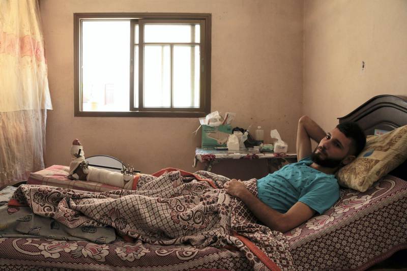 Abdallah Derwish lies on his head in his family home on June 6, 2018, after an Israeli sniper shattered his leg on March 30. Florian Neuhof for The National