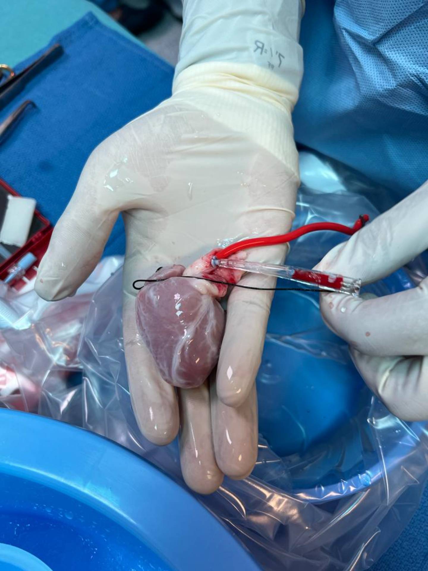 The heart from a baby who died in the UAE was transplanted into the Emirati infant. Photo: King Faisal Specialist Hospital and Research Centre