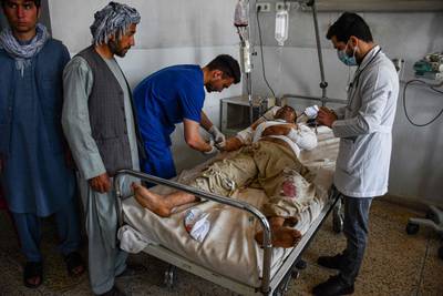 A wounded Afghan man receives hospital treatment after the blast. AFP