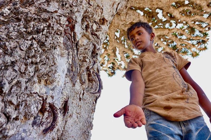 A youth holds up the red resin of the Dragon’s Blood Tree on the Diksam Plateau in the centre of the Yemeni island of Socotra, a species found only on the Indian Ocean archipelago. AFP