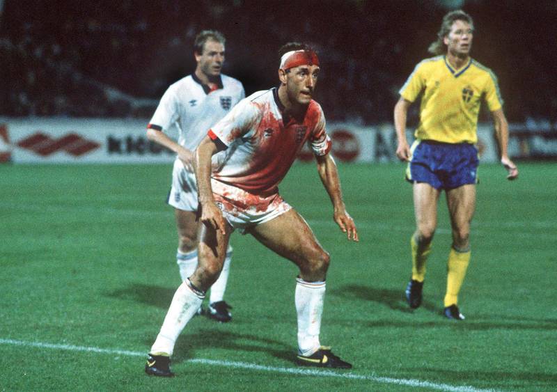 Mandatory Credit: Photo by Colorsport/REX/Shutterstock (3114005a)
Terry Butcher (Eng) covered in blood from a cut head Sweden v England 6/9/89 World Cup Qualifier Group 2 1989 WC1990 Qual: Sweden 0 England 0
Sport