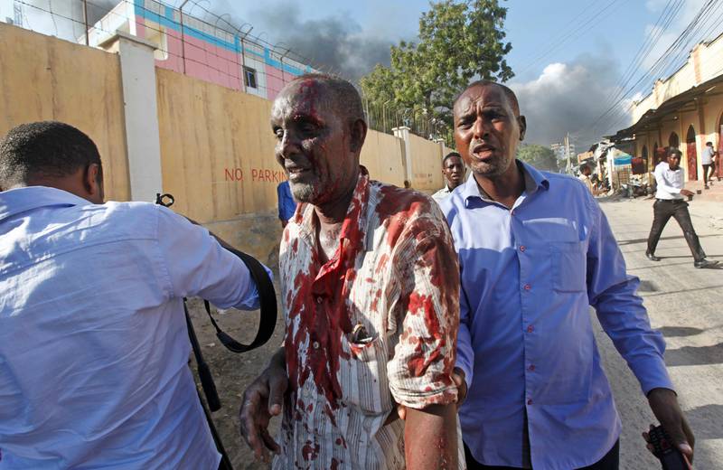 Somalis help a man wounded after a blast in the capital Mogadishu. Farah Abdi Warsameh / AP Photo